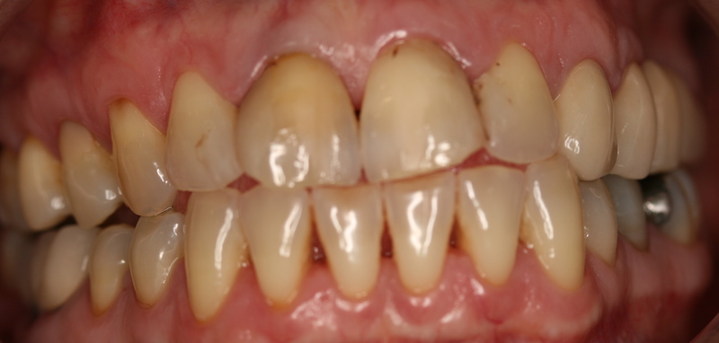 Clínica Dental Oviedo Amoedo