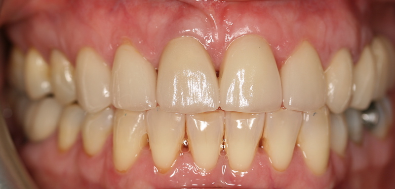 Clínica Dental Oviedo Amoedo