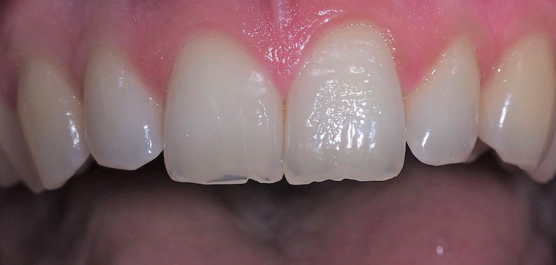 Clínica Dental Oviedo Amoedo