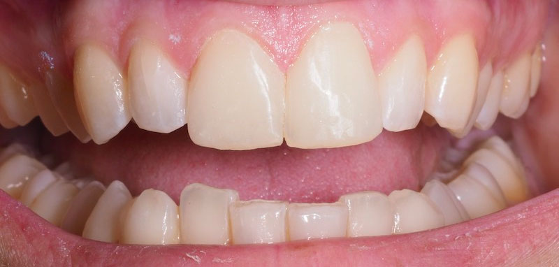 Clínica Dental Oviedo Amoedo