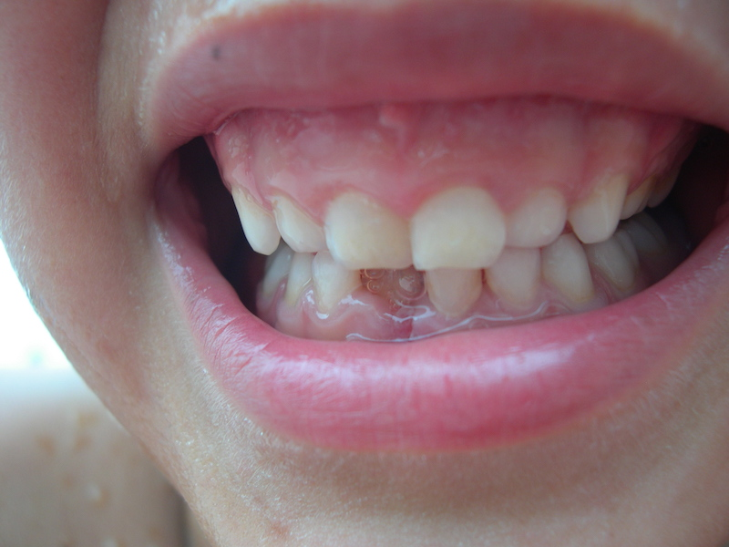 Clínica Dental Oviedo Amoedo