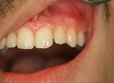 Clínica Dental Oviedo Amoedo