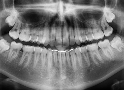 Clínica Dental Oviedo Amoedo