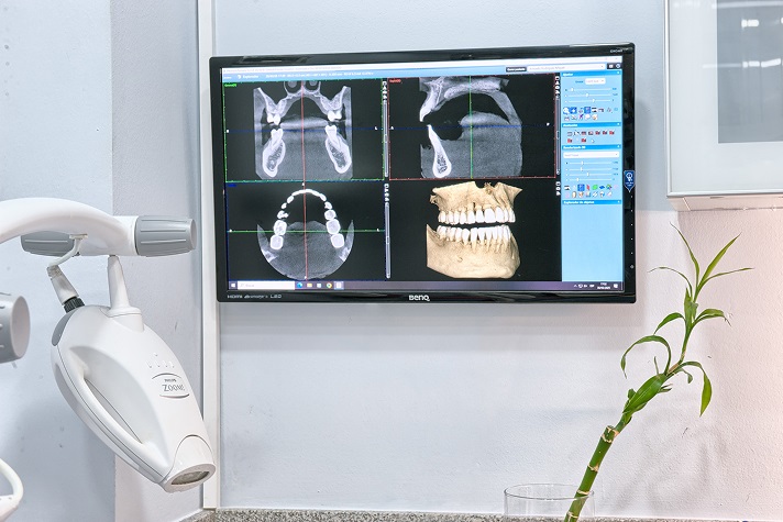 Aparatos de radiología de la clínica dental Amoedo de Oviedo
