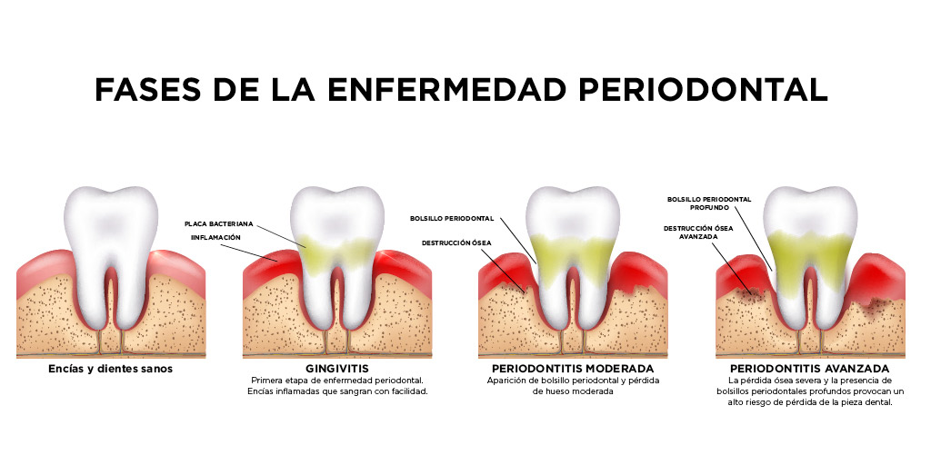 Clínica Dental Oviedo Amoedo