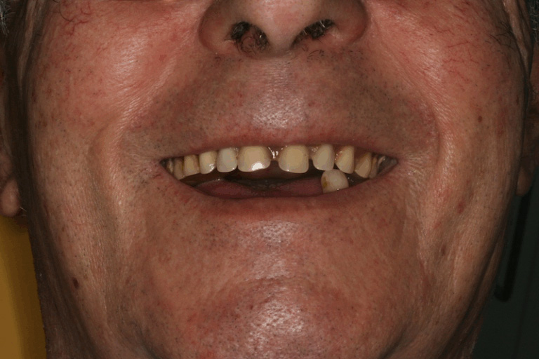 Clínica Dental Oviedo Amoedo