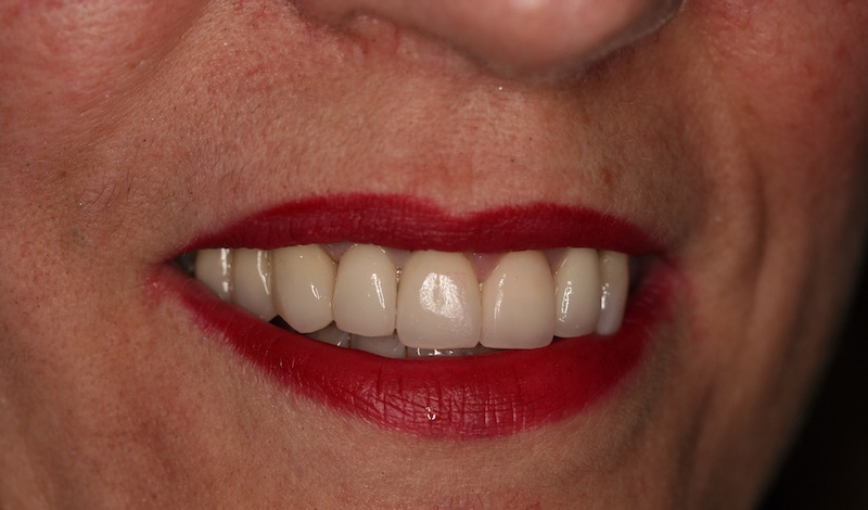 Clínica Dental Oviedo Amoedo