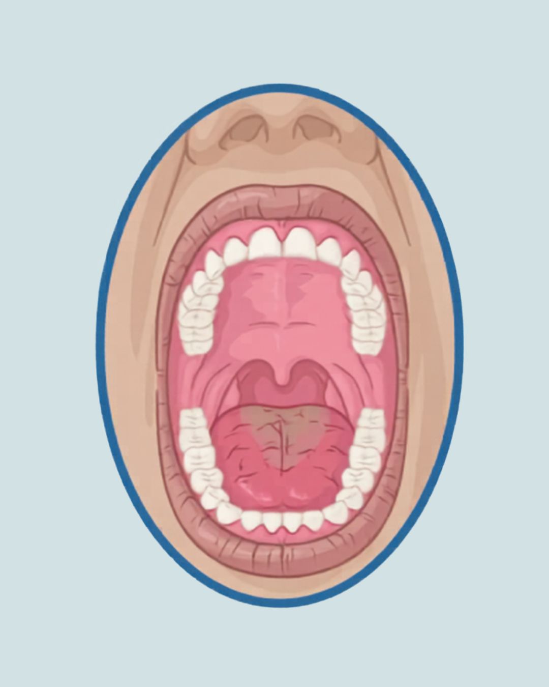 Dentista en Oviedo - Clínica Amoedo Xerostomía: ¿Por qué sientes la boca seca y cómo puede afectar a tu salud dental?