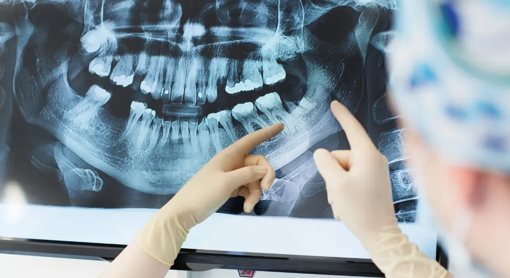 Dentista en Oviedo - Clínica Amoedo Radiografías dentales: la tecnología invisible que protege tu sonrisa