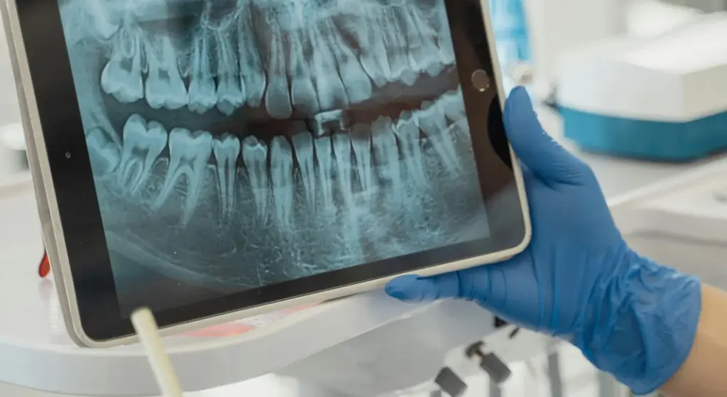 Dentista en Oviedo - Clínica Amoedo Clínica Dental Oviedo Amoedo