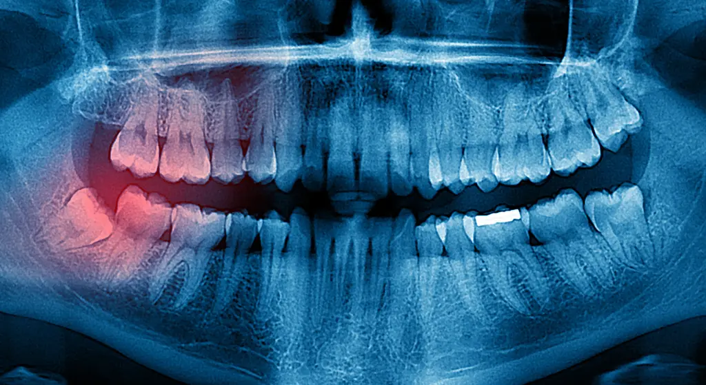 Dentista en Oviedo - Clínica Amoedo Clínica Dental Oviedo Amoedo